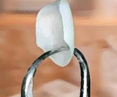 Studio Dentistico - Faccette sottilissime per trattamenti