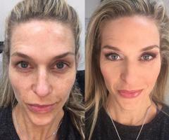 Miky MakeUp - Prima e dopo di Jilll Cooper