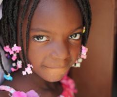 Una bambina curata da Emergenza Sorrisi