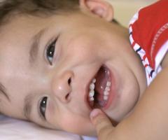 Un bambino afgano affetto da labiopalatoschisi operato in Italia