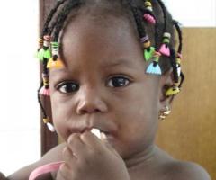 Una bambina indonesiana affetta da palatoschisi